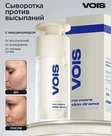 VOIS, сыворотка для лица набор с ниацинамидом и салициловой кислотой от прыщей, 30 мл — фото 1