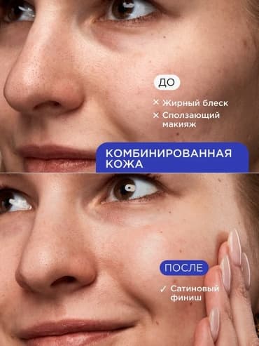VOIS, крем для лица увлажняющий с гиалуроновой кислотой, 50 мл — фото 5