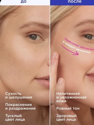 VOIS, крем для лица увлажняющий с витамином С от пигментации, 50 мл — фото 6