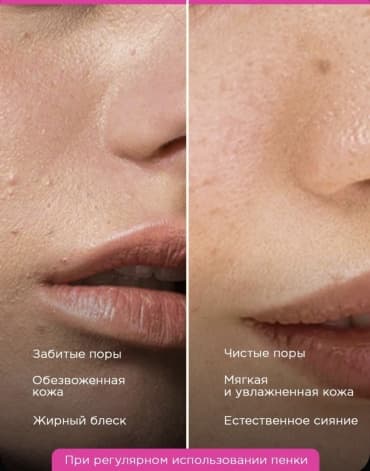 VOIS, пенка для умывания лица умывалка, 150 мл — фото 3