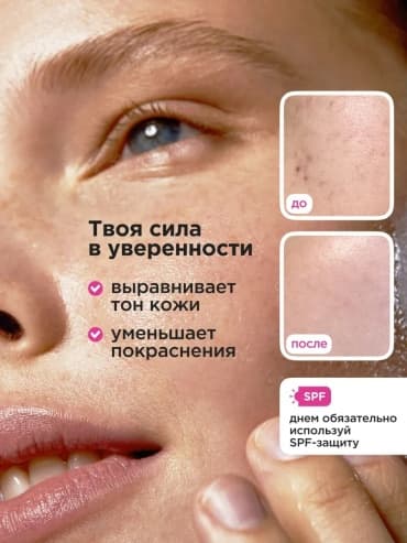 VOIS, сыворотка для лица с азелаиновой кислотой 10% от прыщей, 30 мл — фото 6